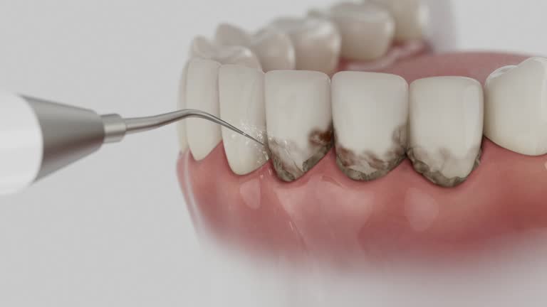 Trusted Wisdom Tooth Removal service in Canon, GA - Dentist Open Now